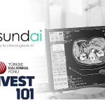 turkiye-kalkinma-fonu-invest101-fonundan-gesund-aiye-yatirim-yapti.jpg