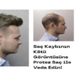 Saç Kaybının Kötü Görüntüsüne Protez Saç ile Veda Edin!