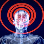 Beyin Tümörü Ameliyatı: Modern Cerrahi ve Bilimsel Gelişmelerle Hayat Kurtaran Bir Süreç