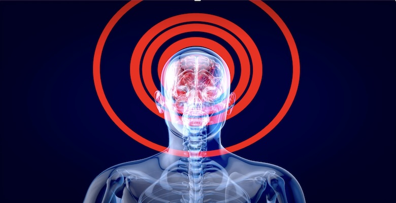 Beyin Tümörü Ameliyatı: Modern Cerrahi ve Bilimsel Gelişmelerle Hayat Kurtaran Bir Süreç