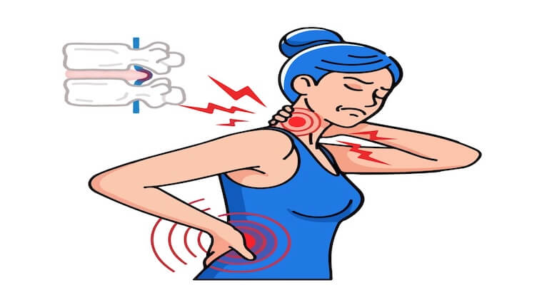 Boyun ve Omuz Ağrısının Sebebi Kullandığınız El Olabilir!